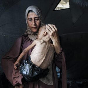 “Food Has Become a Memory”: My Hunger Diary in Gaza 5